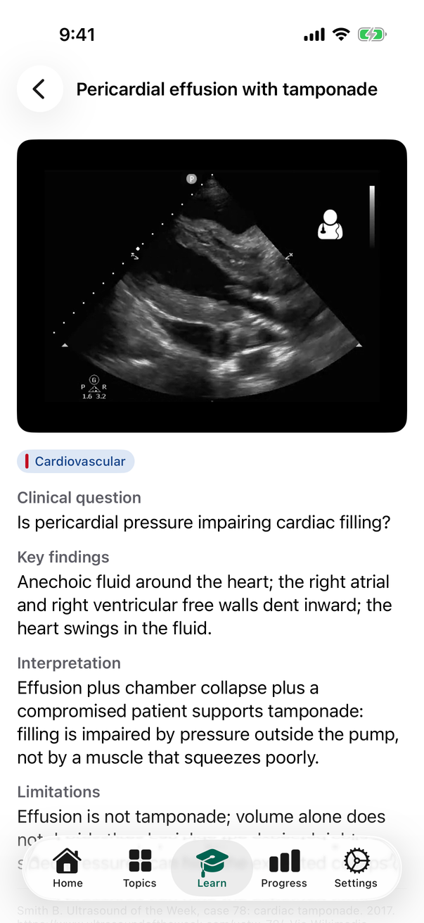 A bedside ultrasound clip page, with the clip and its labelled findings